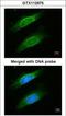 Keratin 8 antibody, GTX112975, GeneTex, Immunocytochemistry image 