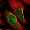 Ring Finger Protein 121 antibody, NBP1-92339, Novus Biologicals, Immunofluorescence image 