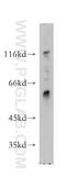 Mitogen-Activated Protein Kinase Kinase Kinase Kinase 5 antibody, 12827-1-AP, Proteintech Group, Western Blot image 
