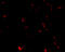 TAR DNA Binding Protein antibody, 4285, ProSci, Immunofluorescence image 