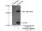 NADH:Ubiquinone Oxidoreductase Complex Assembly Factor 2 antibody, 13891-1-AP, Proteintech Group, Immunoprecipitation image 