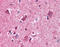Pro-Apoptotic WT1 Regulator antibody, 51-362, ProSci, Immunohistochemistry frozen image 