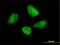 Programmed Cell Death 6 Interacting Protein antibody, ab88743, Abcam, Immunocytochemistry image 