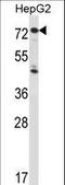 Interleukin 1 Receptor Type 1 antibody, LS-C165189, Lifespan Biosciences, Western Blot image 