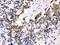 Cyclin Dependent Kinase 4 antibody, PB9535, Boster Biological Technology, Immunohistochemistry frozen image 