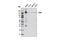 Protein Tyrosine Kinase 7 (Inactive) antibody, 11926S, Cell Signaling Technology, Western Blot image 