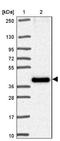 Transmembrane Protein 184C antibody, NBP2-30760, Novus Biologicals, Western Blot image 