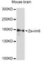 Zinc Finger SWIM-Type Containing 8 antibody, abx126815, Abbexa, Western Blot image 
