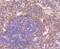 CD27 Molecule antibody, NBP2-75434, Novus Biologicals, Immunohistochemistry paraffin image 