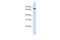 Zinc Finger Protein 714 antibody, A15091, Boster Biological Technology, Western Blot image 