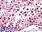SPANX Family Member C antibody, LS-B424, Lifespan Biosciences, Immunohistochemistry frozen image 