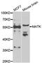 Megakaryocyte-Associated Tyrosine Kinase antibody, PA5-76975, Invitrogen Antibodies, Western Blot image 