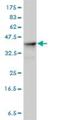 Aldolase, Fructose-Bisphosphate A antibody, H00000226-M01, Novus Biologicals, Western Blot image 