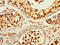 Ret Finger Protein Like 4B antibody, LS-C396581, Lifespan Biosciences, Immunohistochemistry paraffin image 