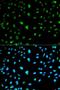 Carbonic Anhydrase 3 antibody, LS-C331356, Lifespan Biosciences, Immunofluorescence image 