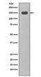 CD11C antibody, M00357-1, Boster Biological Technology, Western Blot image 
