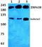 Zinc Finger Protein 638 antibody, PA5-37001, Invitrogen Antibodies, Western Blot image 