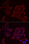 Pannexin 1 antibody, LS-C748633, Lifespan Biosciences, Immunofluorescence image 