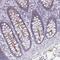 Phosphatidylinositol Glycan Anchor Biosynthesis Class Z antibody, NBP2-32394, Novus Biologicals, Immunohistochemistry paraffin image 