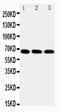 Interleukin 1 Receptor Associated Kinase 3 antibody, LS-C343931, Lifespan Biosciences, Western Blot image 