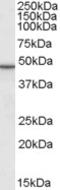 Perilipin 3 antibody, LS-B3639, Lifespan Biosciences, Western Blot image 