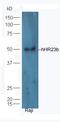 HECT, C2 And WW Domain Containing E3 Ubiquitin Protein Ligase 1 antibody, orb157479, Biorbyt, Western Blot image 