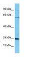 SEL1L2 Adaptor Subunit Of ERAD E3 Ligase antibody, orb327103, Biorbyt, Western Blot image 