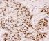 Tumor Protein P63 antibody, R31572, NSJ Bioreagents, Western Blot image 