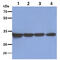 OTU Deubiquitinase, Ubiquitin Aldehyde Binding 1 antibody, GTX57636, GeneTex, Western Blot image 