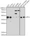 Eukaryotic translation initiation factor 2 subunit 1 antibody, GTX64363, GeneTex, Western Blot image 