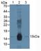 Damage Specific DNA Binding Protein 2 antibody, MBS2028687, MyBioSource, Western Blot image 