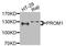 Prominin 1 antibody, STJ111956, St John