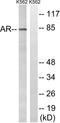 Androgen Receptor antibody, LS-C118329, Lifespan Biosciences, Western Blot image 