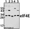 Eukaryotic Translation Initiation Factor 4E antibody, A00135T203, Boster Biological Technology, Western Blot image 