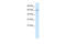 Tripartite Motif Containing 17 antibody, 28-121, ProSci, Western Blot image 