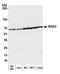 RIO Kinase 3 antibody, A305-602A-M, Bethyl Labs, Western Blot image 