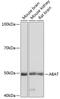 4-Aminobutyrate Aminotransferase antibody, GTX32420, GeneTex, Western Blot image 
