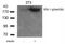 Insulin Receptor Substrate 1 antibody, NB100-82003, Novus Biologicals, Western Blot image 