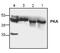 Protein Kinase CAMP-Activated Catalytic Subunit Alpha antibody, PA1-30236, Invitrogen Antibodies, Western Blot image 