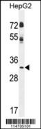 Cyclin G1 antibody, 55-782, ProSci, Western Blot image 