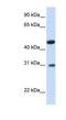 Glycolipid Transfer Protein Domain Containing 2 antibody, NBP1-80542, Novus Biologicals, Western Blot image 