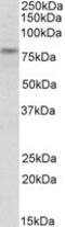 Tripartite Motif Containing 2 antibody, LS-C139773, Lifespan Biosciences, Western Blot image 