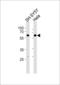 Histone Deacetylase 2 antibody, LS-C166821, Lifespan Biosciences, Western Blot image 