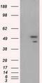 SHC Adaptor Protein 1 antibody, GTX83655, GeneTex, Western Blot image 