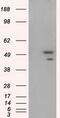 SHC-transforming protein 1 antibody, GTX83655, GeneTex, Western Blot image 