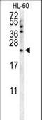 Coenzyme Q7, Hydroxylase antibody, LS-C166951, Lifespan Biosciences, Western Blot image 