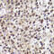 Checkpoint Kinase 2 antibody, 13-179, ProSci, Immunohistochemistry frozen image 