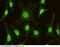 Interferon Regulatory Factor 6 antibody, 100302-MM06, Sino Biological, Immunohistochemistry paraffin image 