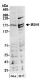 hMSH6 antibody, A300-023A, Bethyl Labs, Western Blot image 