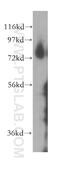 Thimet Oligopeptidase 1 antibody, 11738-1-AP, Proteintech Group, Western Blot image 